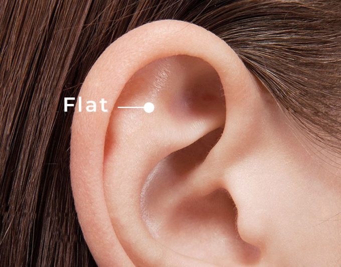 Flatpiercing