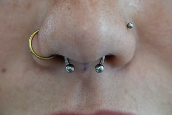 septum-1