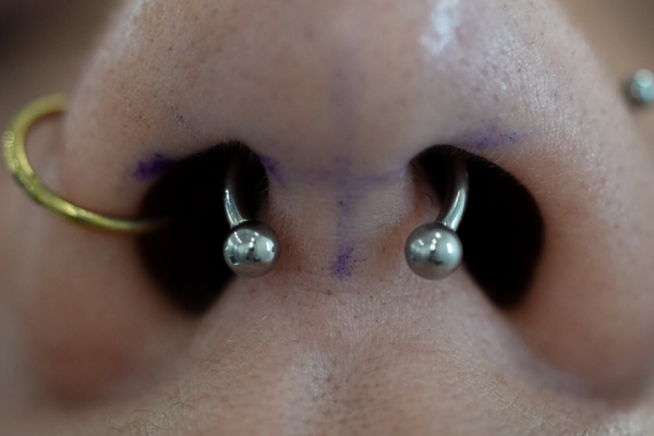 septum-2